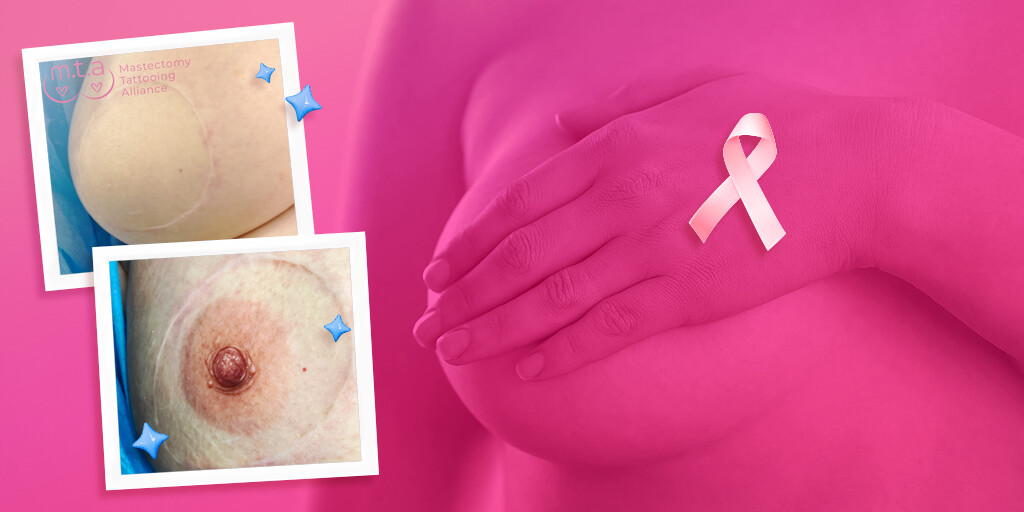 What Is Areola Tattooing? - Killer Beauty