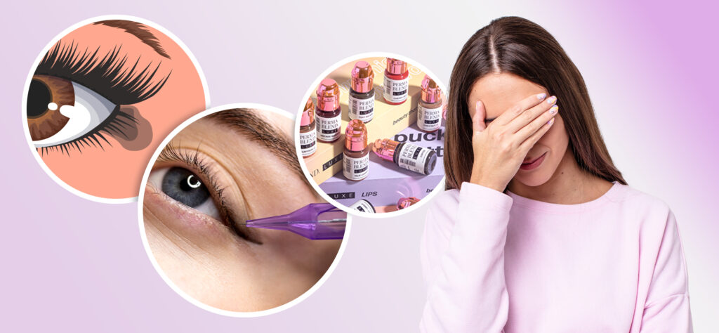 Addressing Pigment Migration in PMU