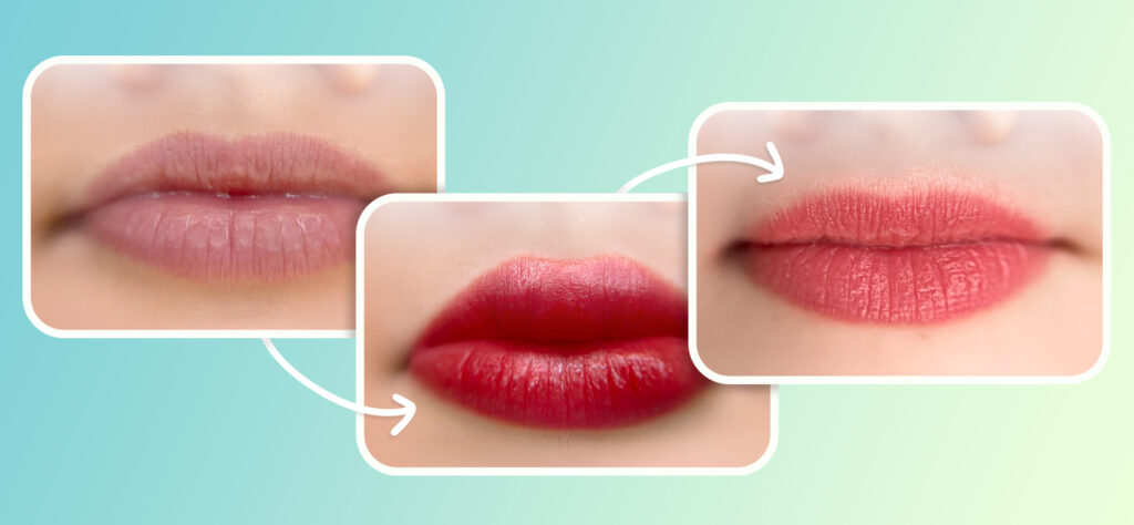 Understanding the Healing Process: What to Expect Post-PMU Procedure